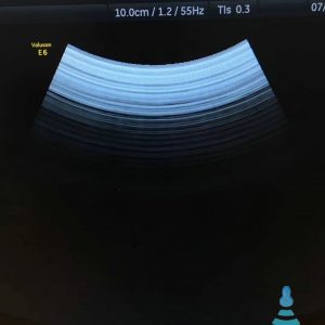 4C-D For GE Voluson E6 CONVEX Transducer Ultrasonido Ultrasonic Sensor Ultrasound Probe REPAIR SERVICE