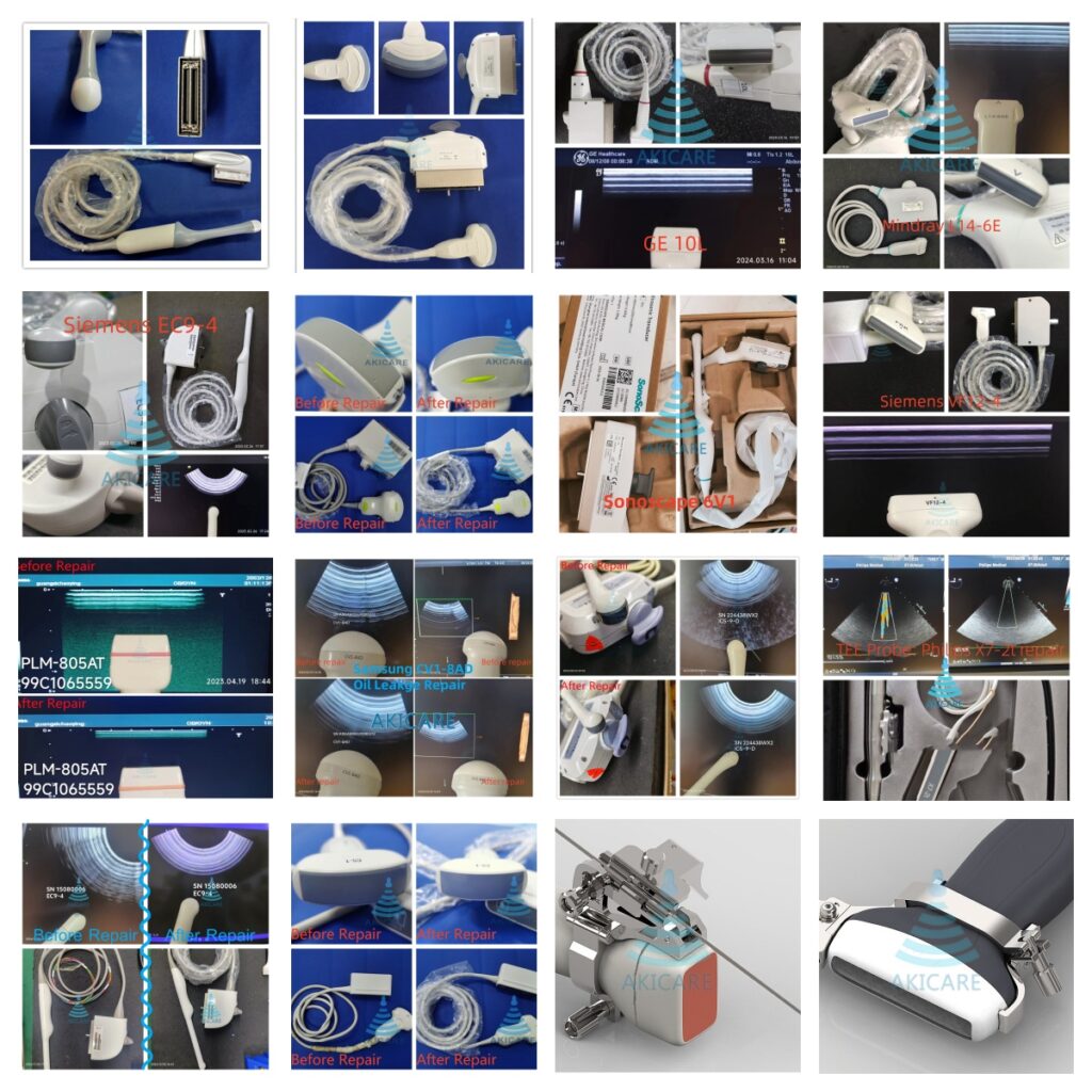 Why choose Akicare in Aloka UST-5543. - Biggset Chinese Ultrasound ...